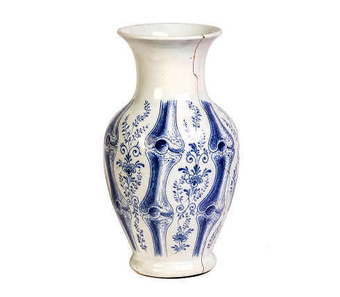 Blue and white ceramic vase decorated with anatomical illustrations of bone joints and floral motifs, with visible crack along the rim and side of the vase.