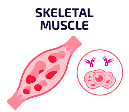 Graphic labeled “Skeletal Muscle” showing a diagram of a skeletal muscle beside icons of autoantibodies interacting with muscle cells.