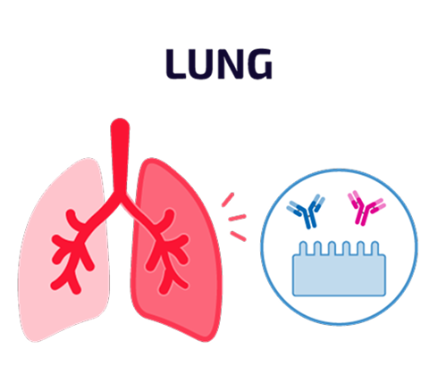 Graphic labeled “Lung” showing a diagram of the lungs beside icons of autoantibodies interacting with cells.