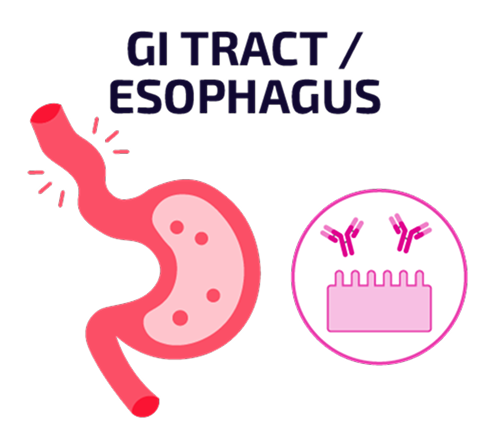 Graphic labeled “GI Tract / Esophagus” showing a simplified diagram of the gastrointestinal tract beside icons of autoantibodies interacting with cells.