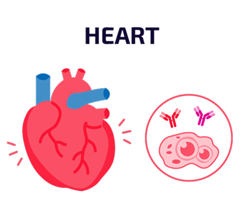 Graphic labeled “Heart” showing a simplified heart diagram beside icons of autoantibodies interacting with cells.